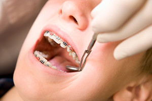 Orthodontic Services